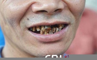 周公解梦梦见掉牙齿(周公解梦梦见掉牙齿掉了) 周公解梦梦见掉牙齿(周公解梦梦见掉牙齿掉了)